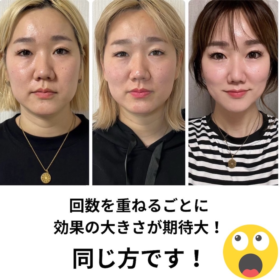 テラボーラーの効果